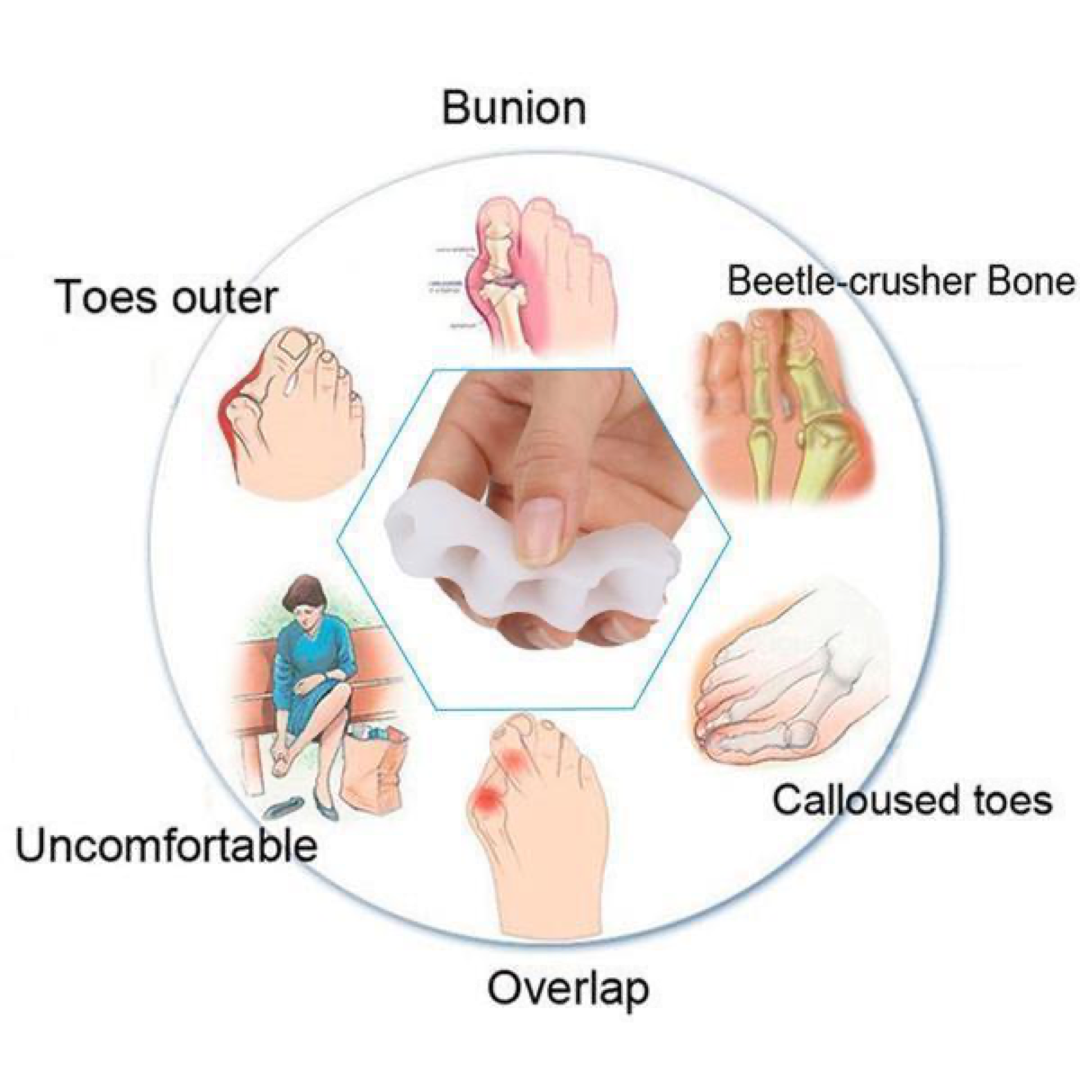 Adjustable Toe Corrector for Everyday Comfort