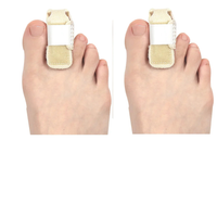 Adjustable Toe Support Wrap for All-Day Relief