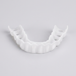 Snap-On Cosmetic Denture for a Natural Smile